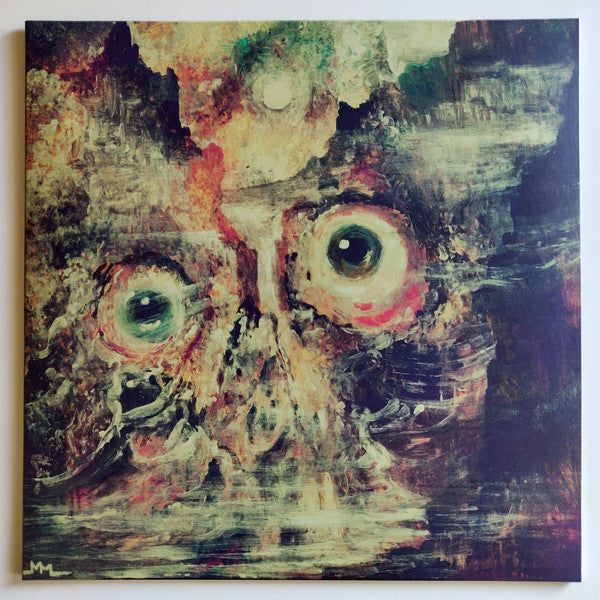 Teratoma – Purulent Manifestations 🇺🇸