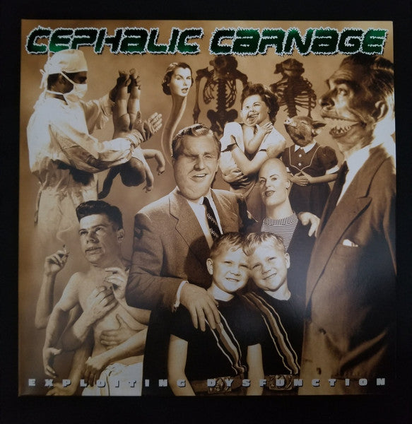 Cephalic Carnage – Exploiting Dysfunction (Deluxe/25TH Anniversary/Reissue) (Custom Merge Vinyl/2LP) 🇺🇸