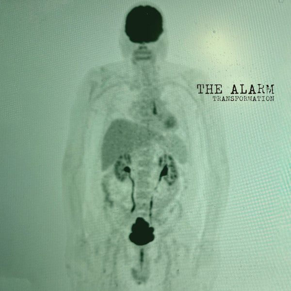 Alarm – Transformation (Green Vinyl) (I) 🇺🇸