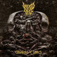 Defeated Sanity – Chronicles of Lunacy 🇺🇸